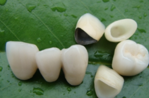 襄阳奥益齿口腔诊所价格表：