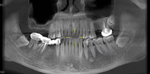 马金盼医生技术优势