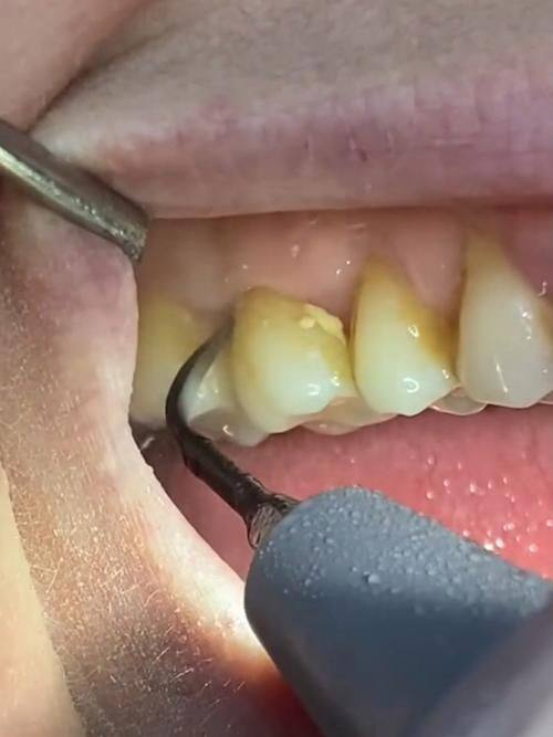 襄阳奥益齿口腔诊所口碑评价：