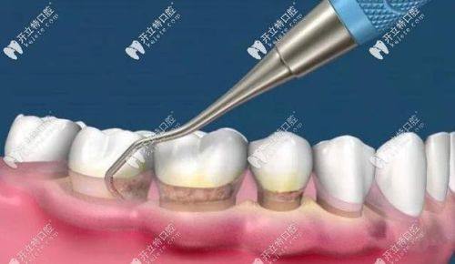 陈春雷医生口碑评价