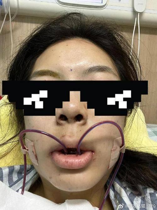 贵阳拜博口腔预约挂号方式: