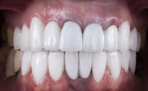 贵阳拜博口腔口碑评价: