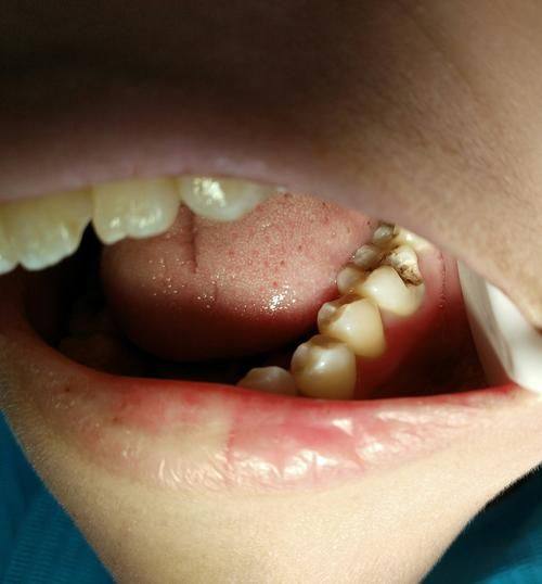 襄阳奥益齿口腔诊所怎么样？