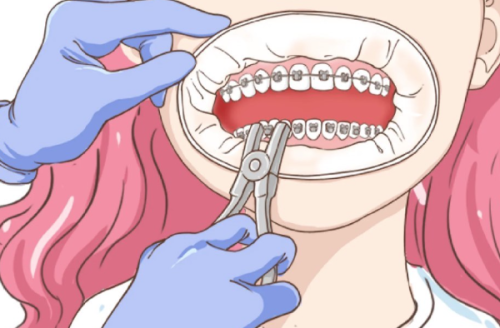 儿童拔牙打麻药的安心性