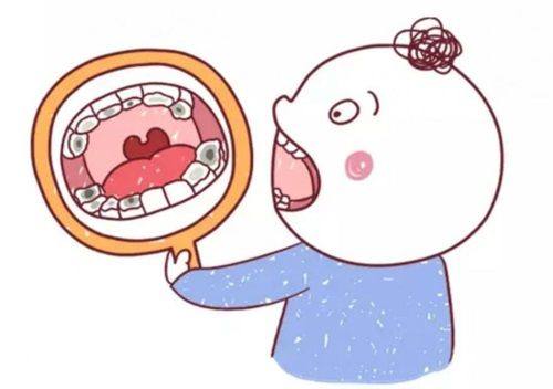 活动义齿的材料怎么选择?