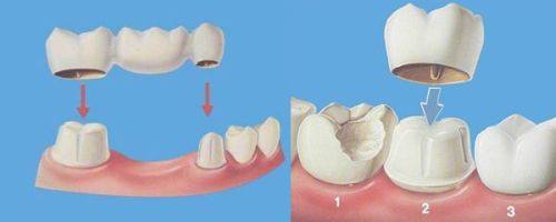 上海拜博口腔(昌仁店)价格表