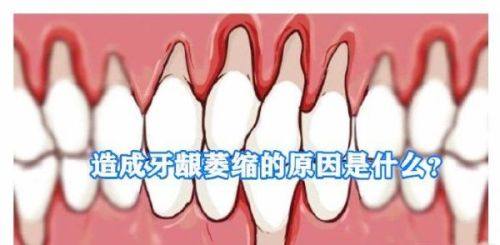 二、前磨牙适配的牙冠类型及参考费用