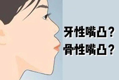 五、3M树脂补牙250和350的区别是什么