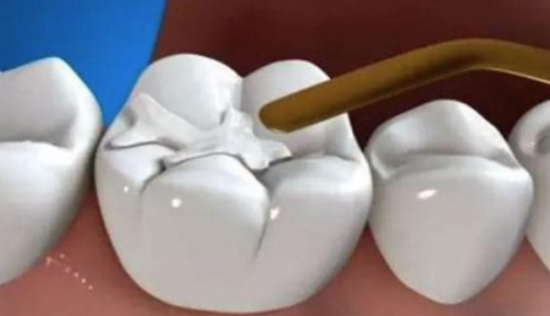 江苏南京章串华口腔价格表: