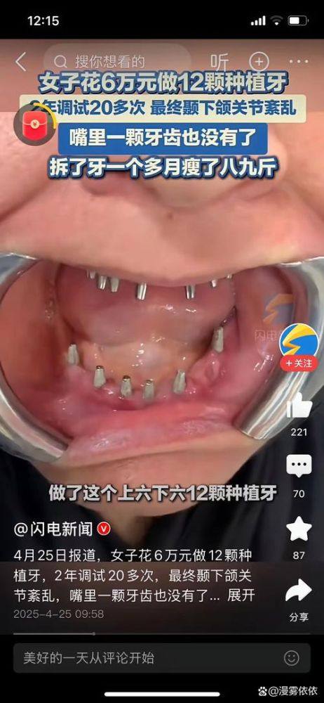 黑龙江大庆市优齿口腔预约挂号方式