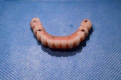 乐山雷开英口腔诊所价格表：