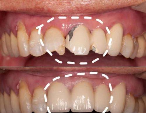 滨海吉达口腔诊所价格表: