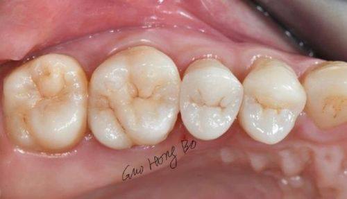 石家庄和协口腔医院怎么样?