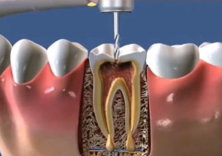 成都市武侯区伯菲口腔价格表: