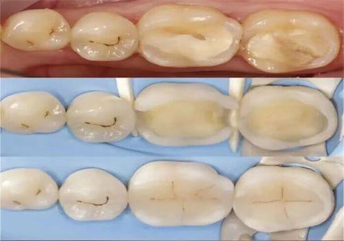 闫杰林医生技术优势