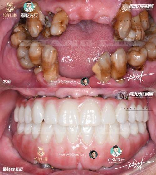 浙江嘉兴英博口腔口碑评价：