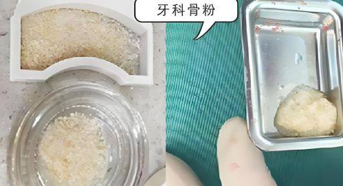 雷开英医生技术优势