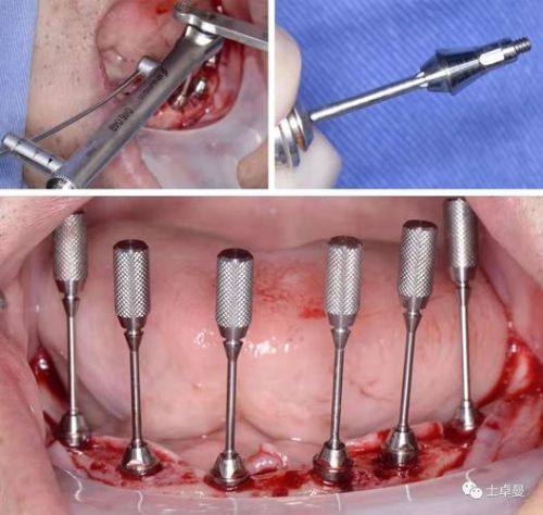 雷开英医生口碑评价