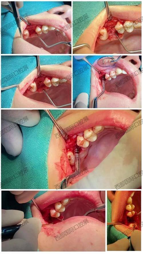 温州江学青口腔擅长项目：