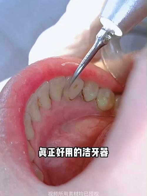 温州江学青口腔口碑评价：