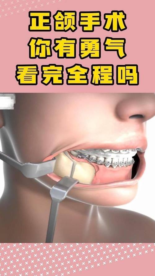 银川贝壳口腔诊所擅长项目：