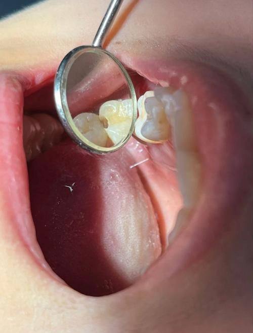 浙江嘉兴英博口腔医生名单及擅长领域：