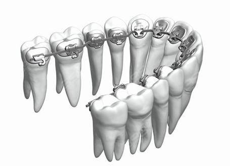 浙江嘉兴英博口腔价格表：