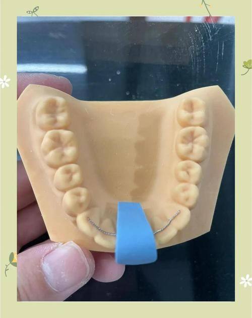 银川贝壳口腔诊所预约挂号方式：