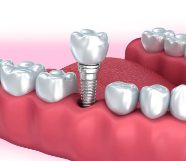 五、这些特殊场景可以灵活选择下午拔牙