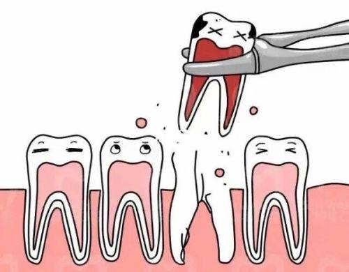 二、为什么多数口腔门诊都会强调拔牙前吃早餐