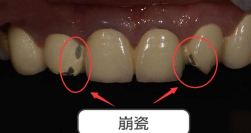 普洱思茅王春口腔诊所地址电话及营业时间：