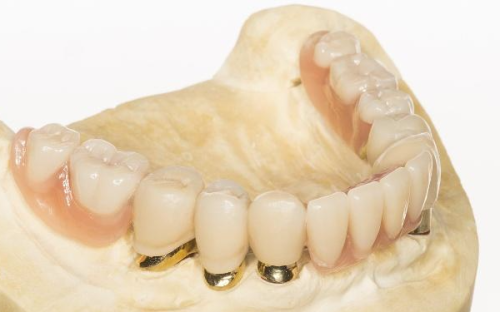 东莞万江中合口腔价格表：