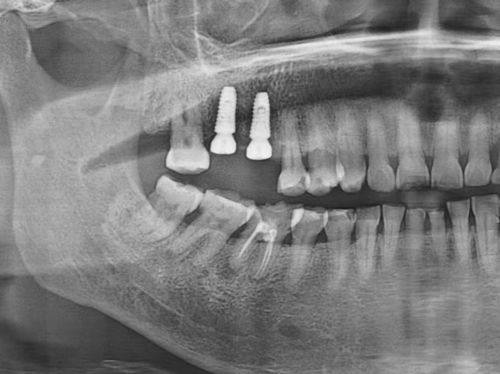 东莞万江中合口腔地址电话及营业时间：