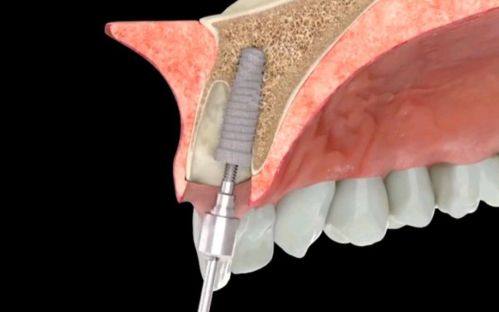 东莞万江中合口腔擅长项目：