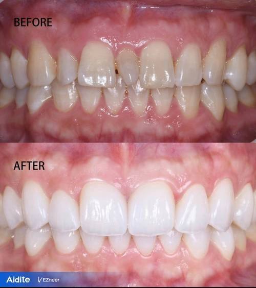 东莞清溪镇德瑞口腔怎么样？