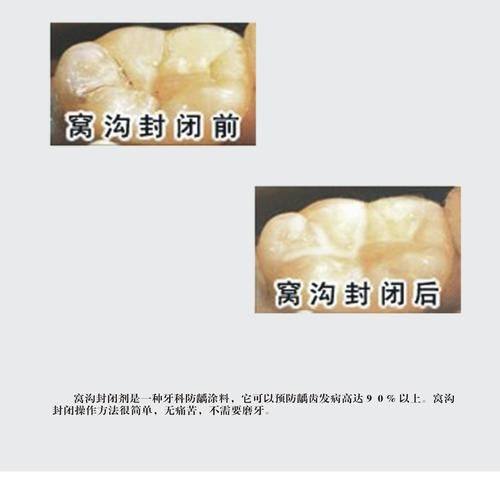 东莞清溪镇德瑞口腔预约挂号方式：