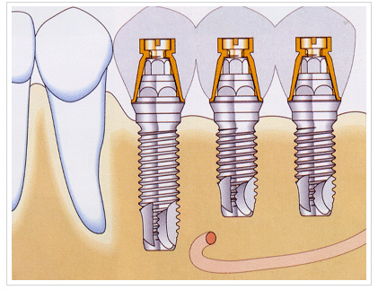 东莞虎门拜尔口腔门诊部