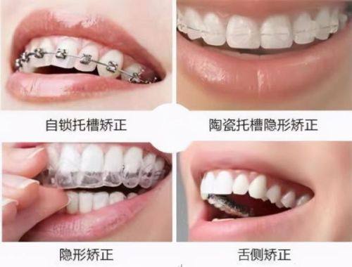 耿阳医生医生技术优势：