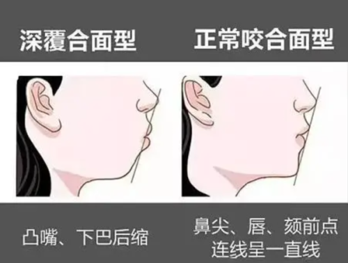 二、树脂补牙是什么材料做成的？核心成分解析