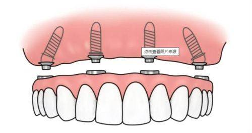 深圳羅湖格倫菲爾口腔醫院怎么样？