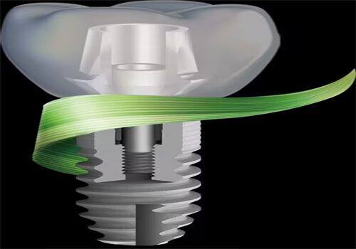 杭州尚维口腔门诊部擅长项目