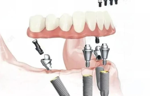 杭州尚维口腔门诊部口碑评价