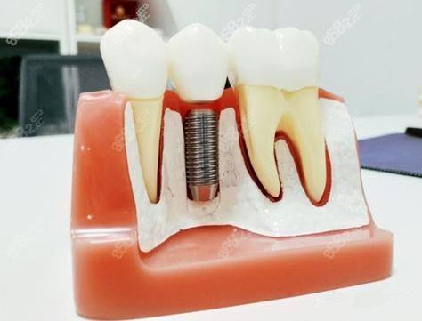 乳山佳和口腔诊所怎么样？