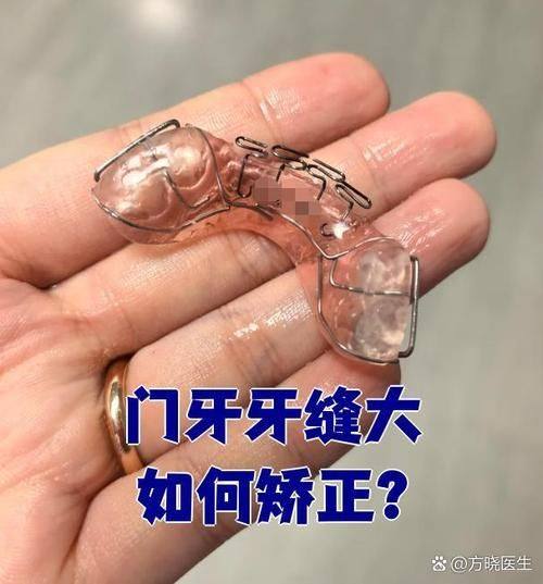 深圳羅湖格倫菲爾口腔醫院口碑评价：