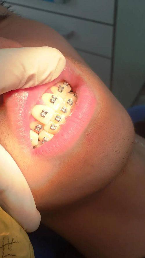 运城市盐湖薛超口腔诊所擅长项目：