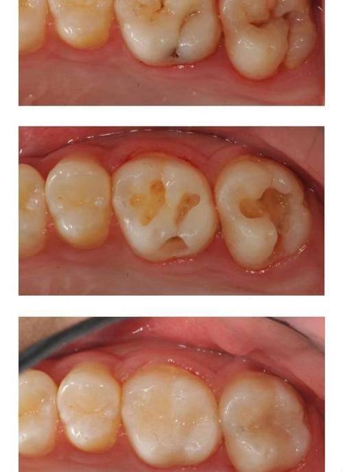 抚州东乡云下口腔擅长项目：