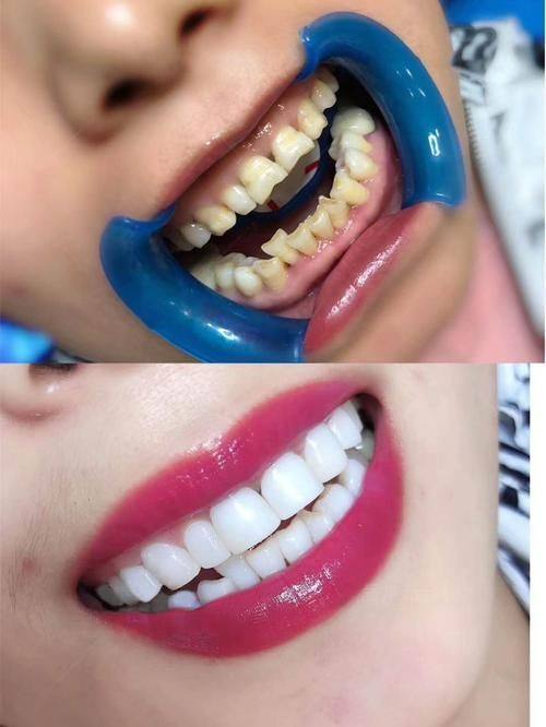 深圳羅湖格倫菲爾口腔醫院地址电话及营业时间：