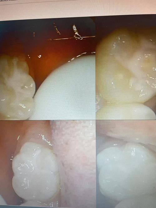 江苏镇江大港宜看牙口腔诊所擅长项目