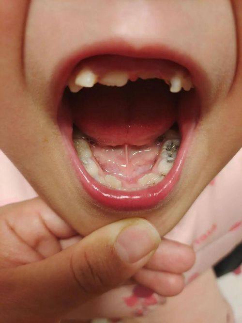 无锡美齿健口腔门诊部擅长项目