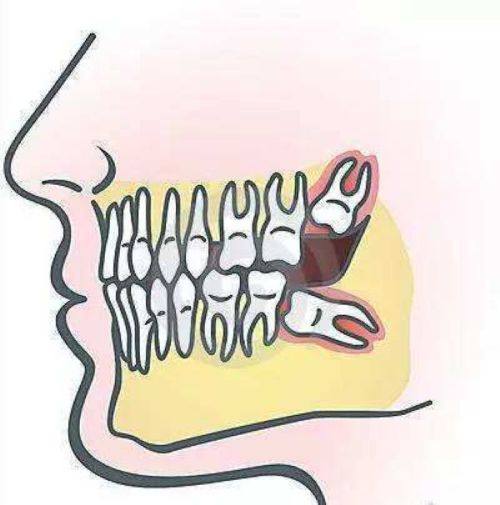 四、肿胀疼痛与用药规范